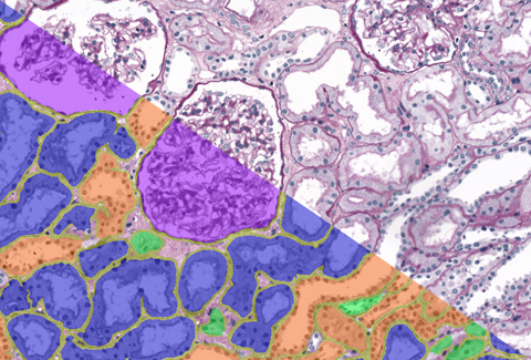 Renal tissue segmentation using Deep learning