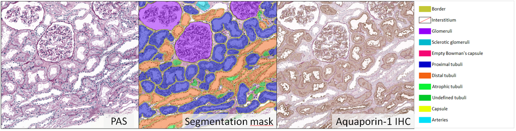 Kidney segmentation