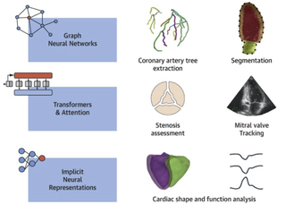 Review paper on deep learning architectures for cardiac image analysis published in JACC: Cardiovascular Imaging
