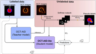 OCT-AID-lite brings automated plaque segmentation closer to real-time clinical use