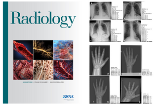 Project AIR Sets the Standard for Commercial AI Products Validation in a Groundbreaking Publication in Radiology