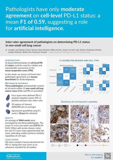 Inter-rater agreement of pathologists on determining PD-L1 status in non-small cell lung cancer