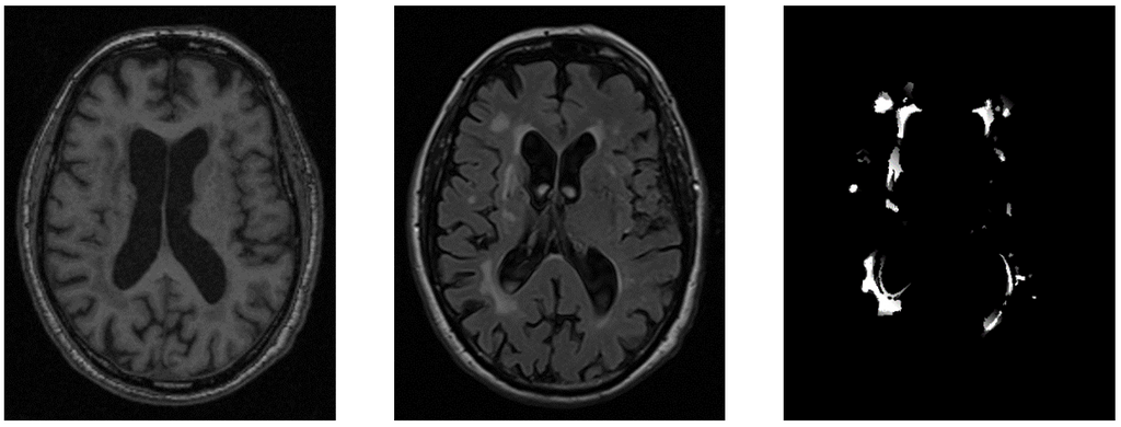 wmh-progression-detection