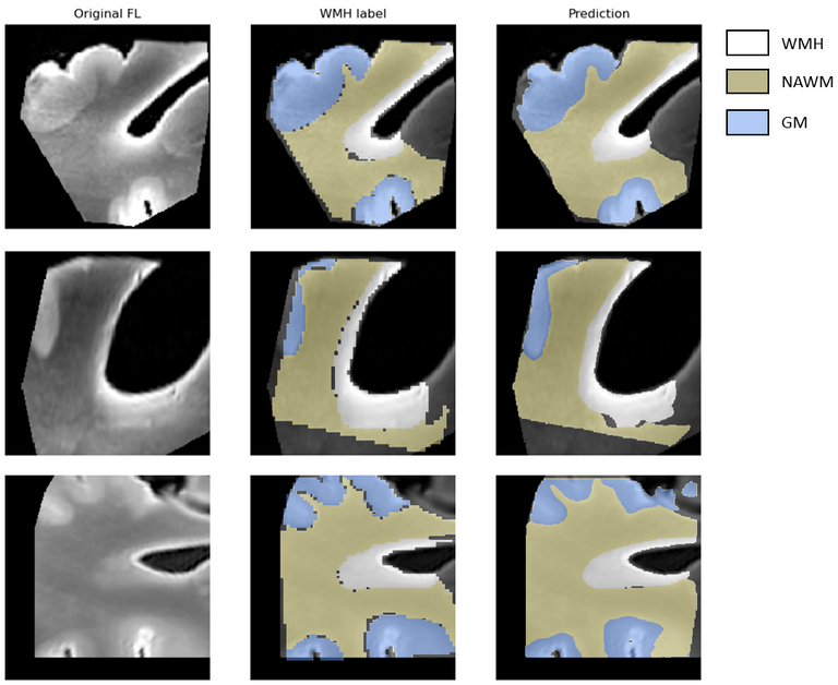 wmh-progression-detection