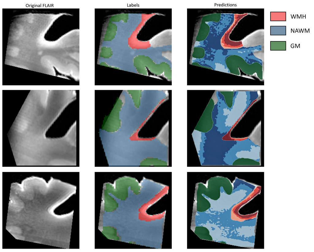 wmh-progression-detection