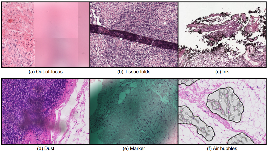 pathology-artifact-detection