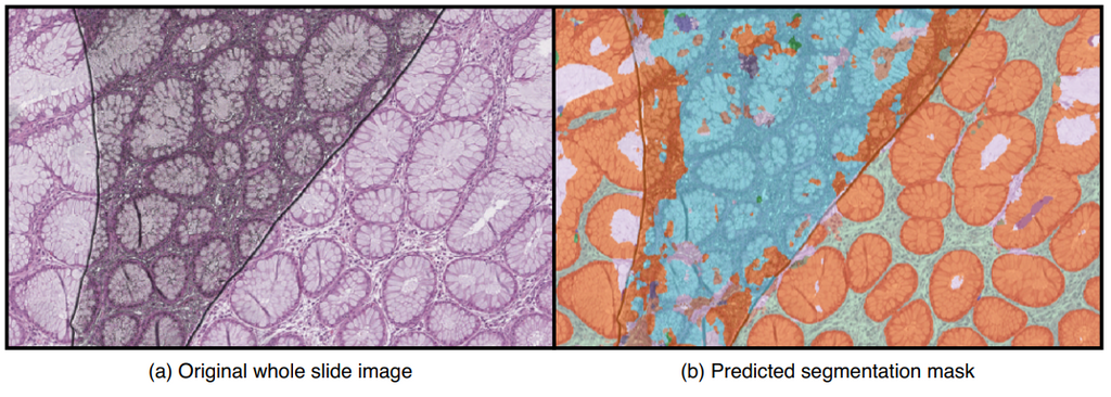 pathology-artifact-detection