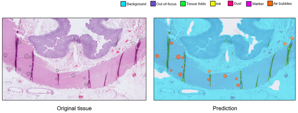 pathology-artifact-detection