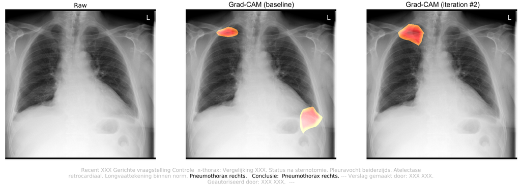 Iterative self-training Grad-CAMs