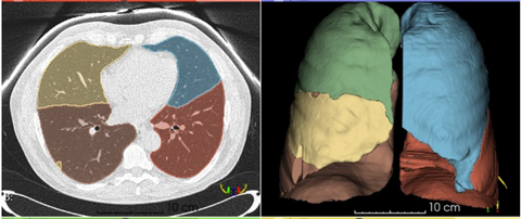 Lung Lobe Segmentation in CT imaging
