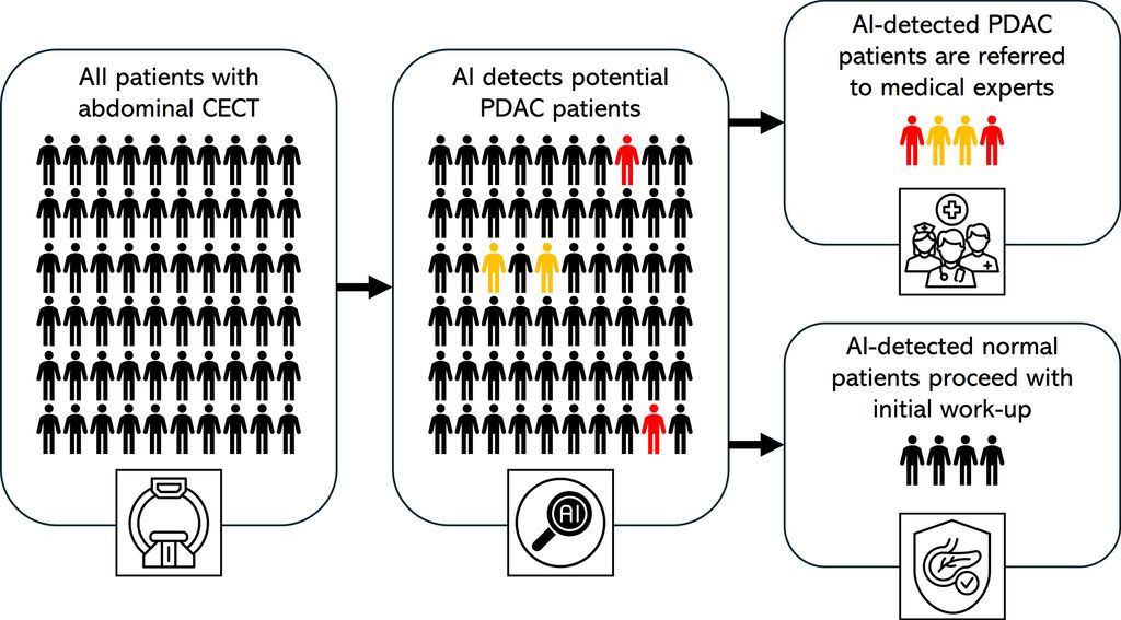 PhD Position: AI-Based Opportunistic Screening of Pancreatic Cancer Using CT Scans