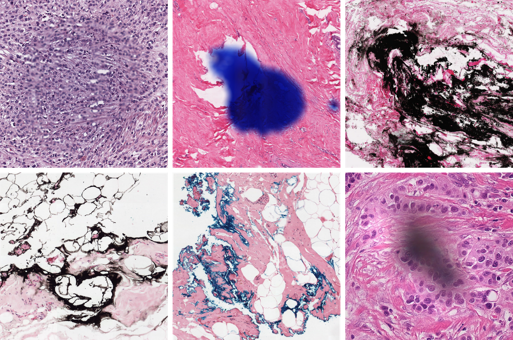 Deep Learning to detect artifacts in whole slide images