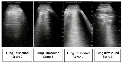 Automated COVID-19 classification using ultrasound