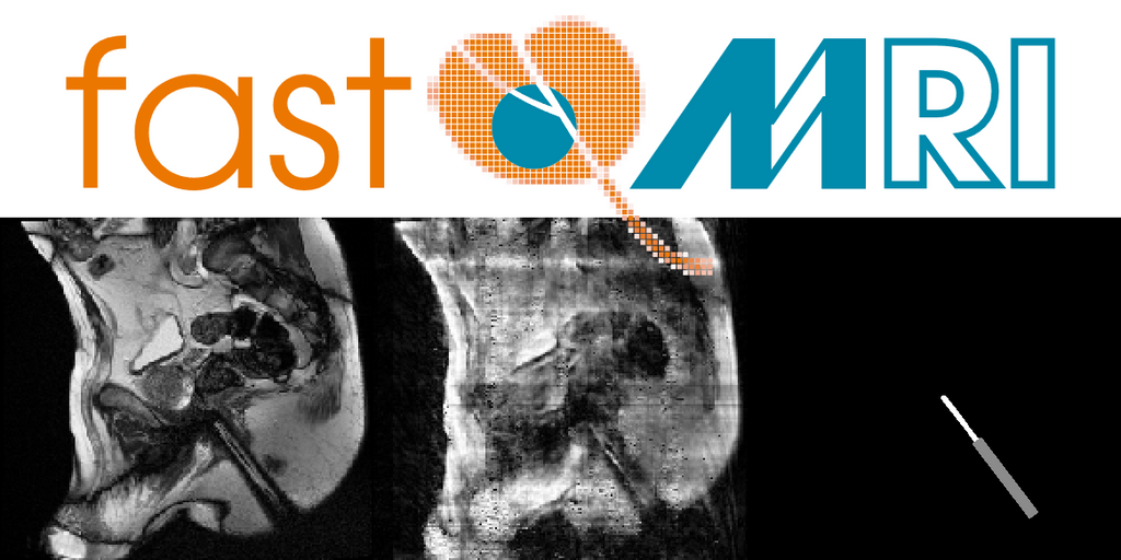 Interventional reconstruction AI for real-time needle tracking in MRI