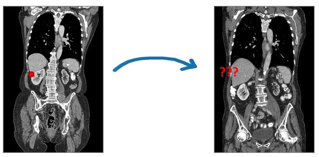 PhD position on deep-learning-based image registration