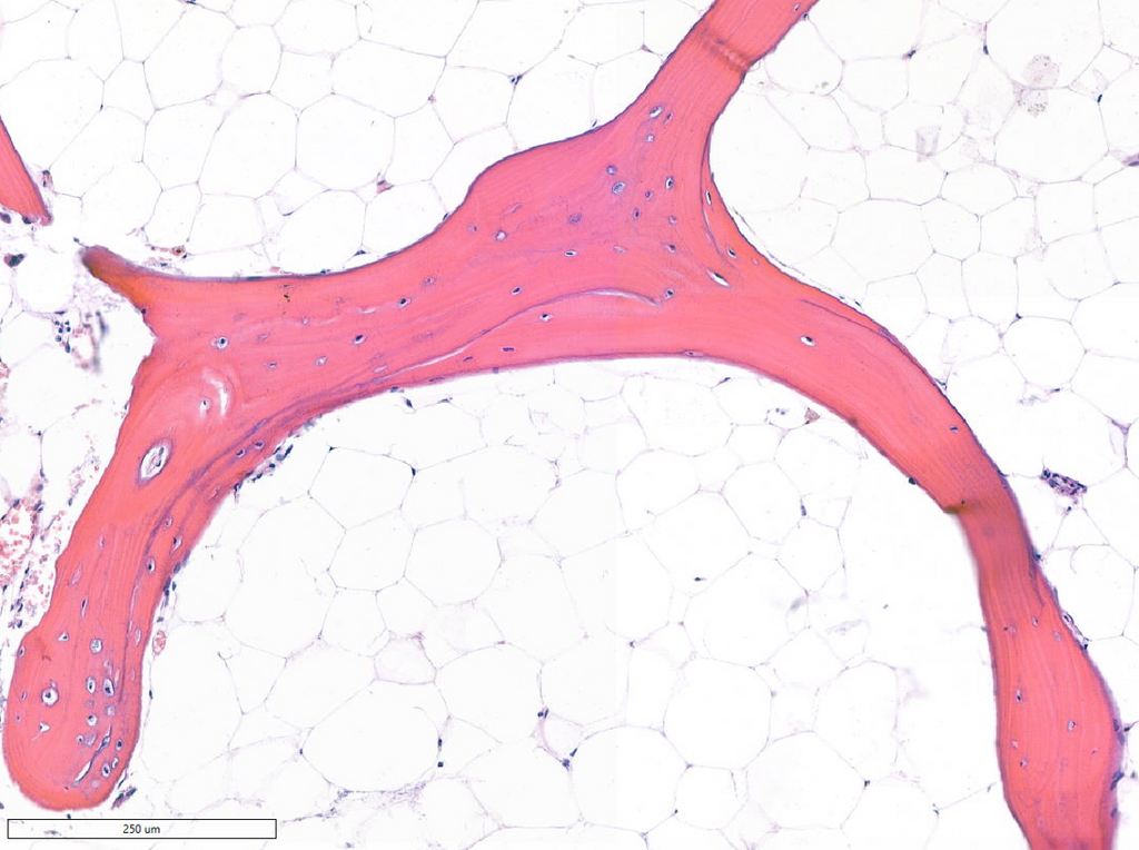 Artificial Intelligence-Based Analysis of Patient-Specific Characteristics in Human Bone Histology