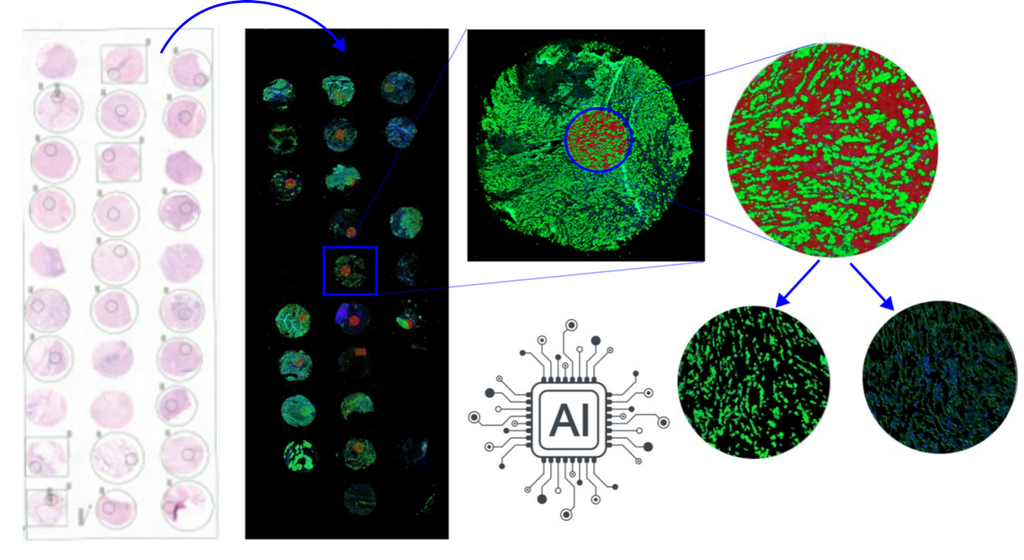 Artificial intelligence to integrate histopathological images and transcriptomics