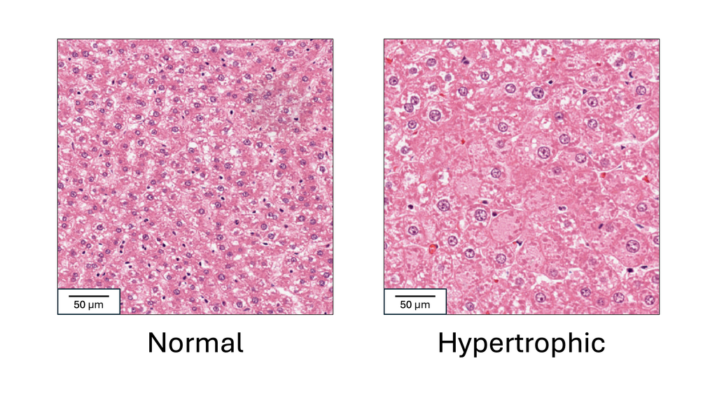 Artificial Intelligence-Based Liver Hypertrophy Detection in Drug Safety Studies