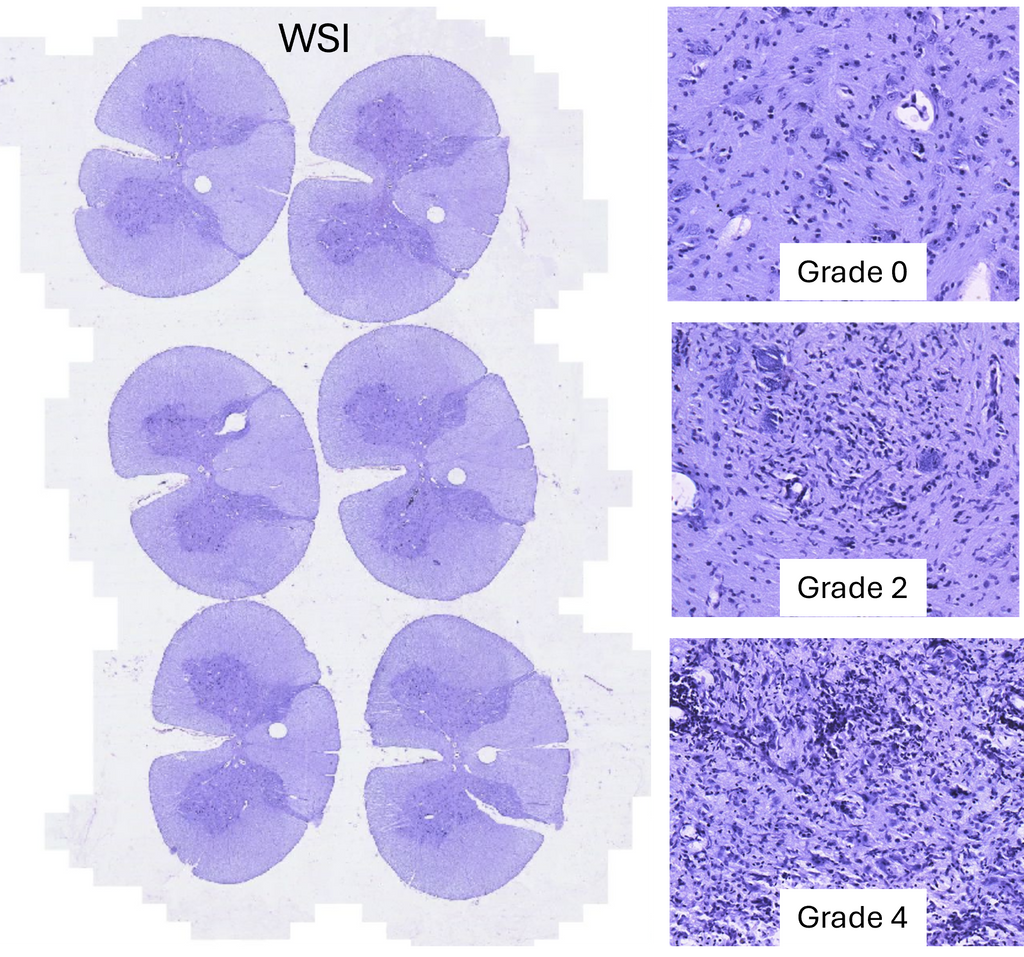 Weakly supervised learning for automated scoring of the Monkey Neurovirulence Test (MNVT) in polio vaccine development