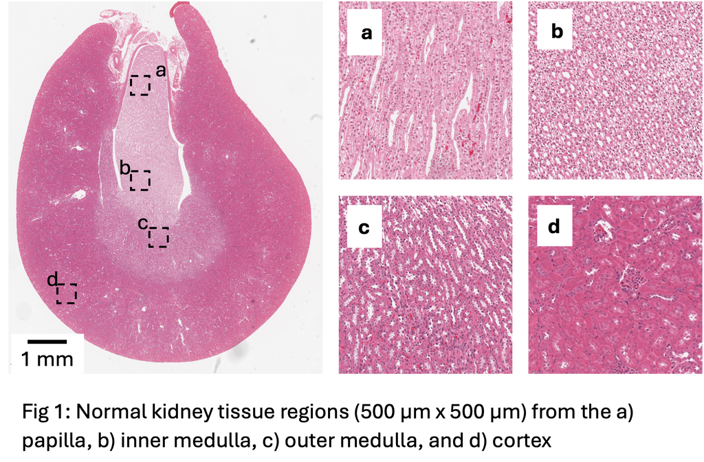 An AI model to detect kidney abnormalities from drug safety testing