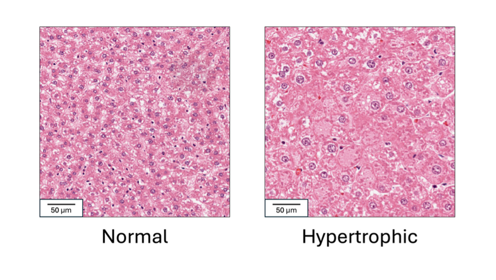 A comparative multi-modal AI model for liver hypertrophy detection in drug safety slides