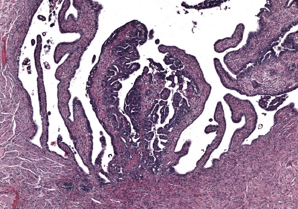 Postdoc 'Deep learning to improve pathology diagnostics'