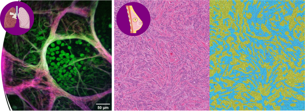 Postdoctoral researchers in two projects on computational pathology