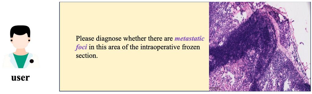 Explainability through Reasoning Segmentation