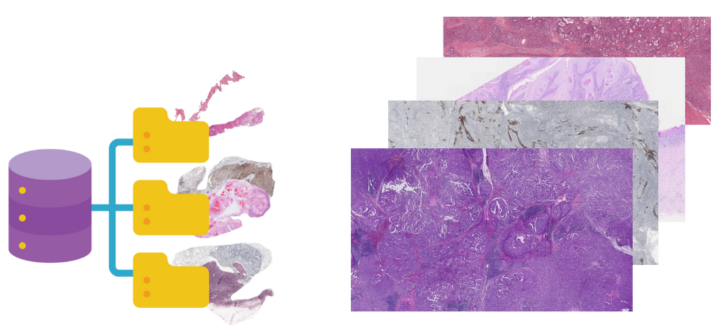 Self-supervised pretraining for digital pathology