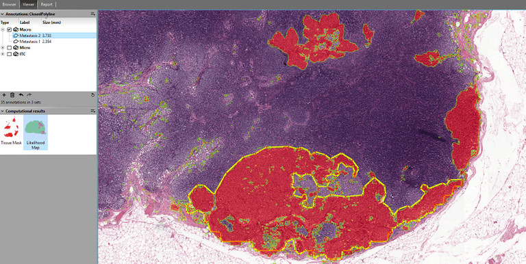 Research Software Engineer in Digital Pathology